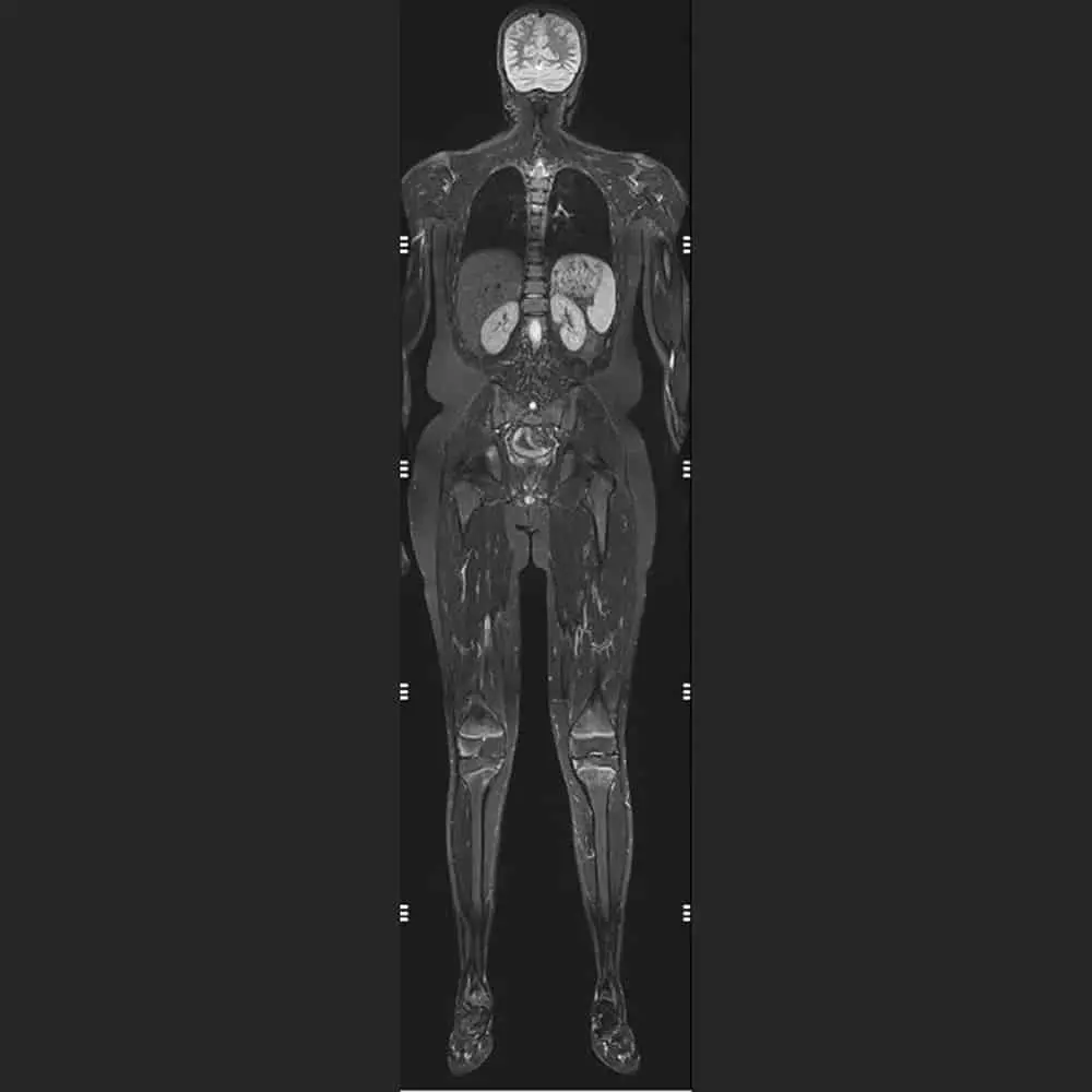 Full Body Scan